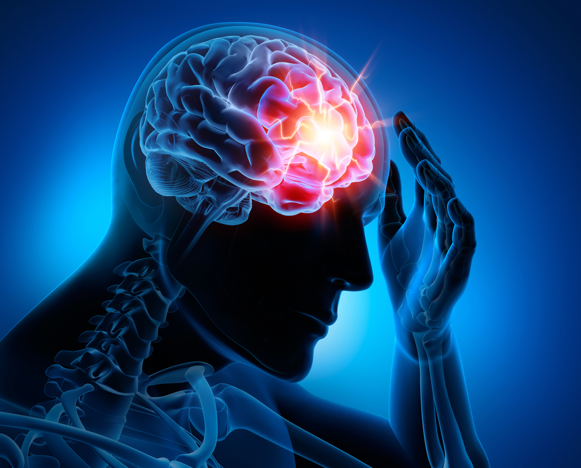 3 D image traumatic brain injury