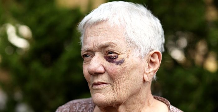 elderly woman who has been abused