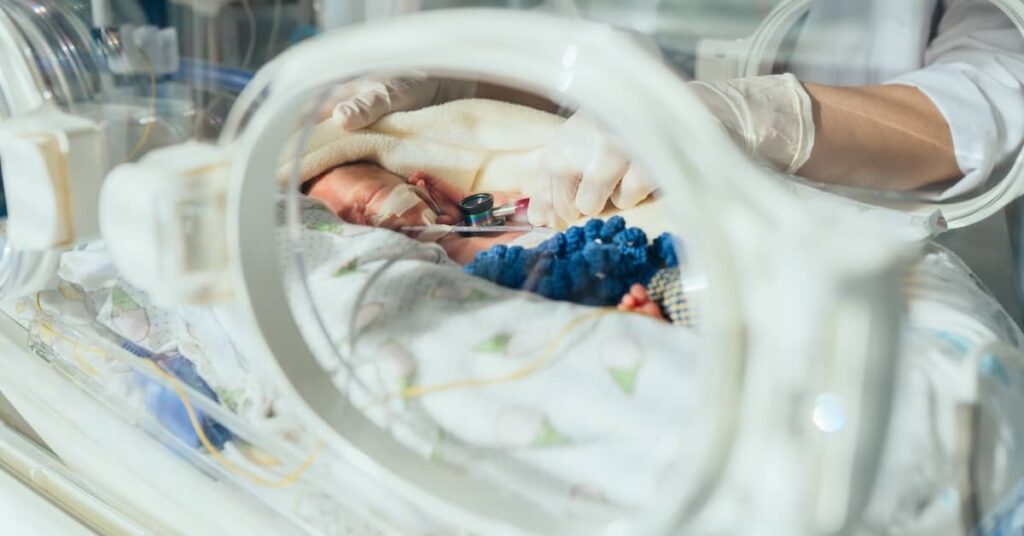 Doctor examining baby in neonatal intensive care unit | Burg Simpson