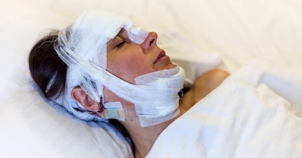 Young woman in a hospital bed with her head bandaged after a catastrophic injury | Burg Simpson