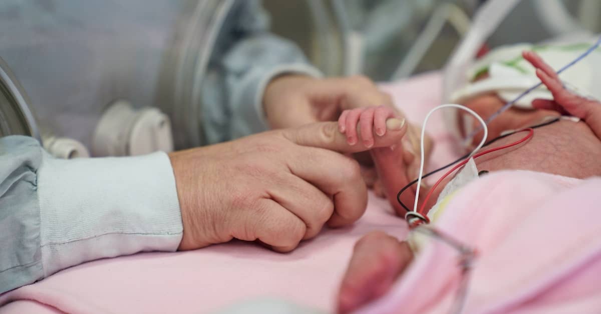 Newborn baby with brain damage receiving treatment in the NICU | Burg Simpson
