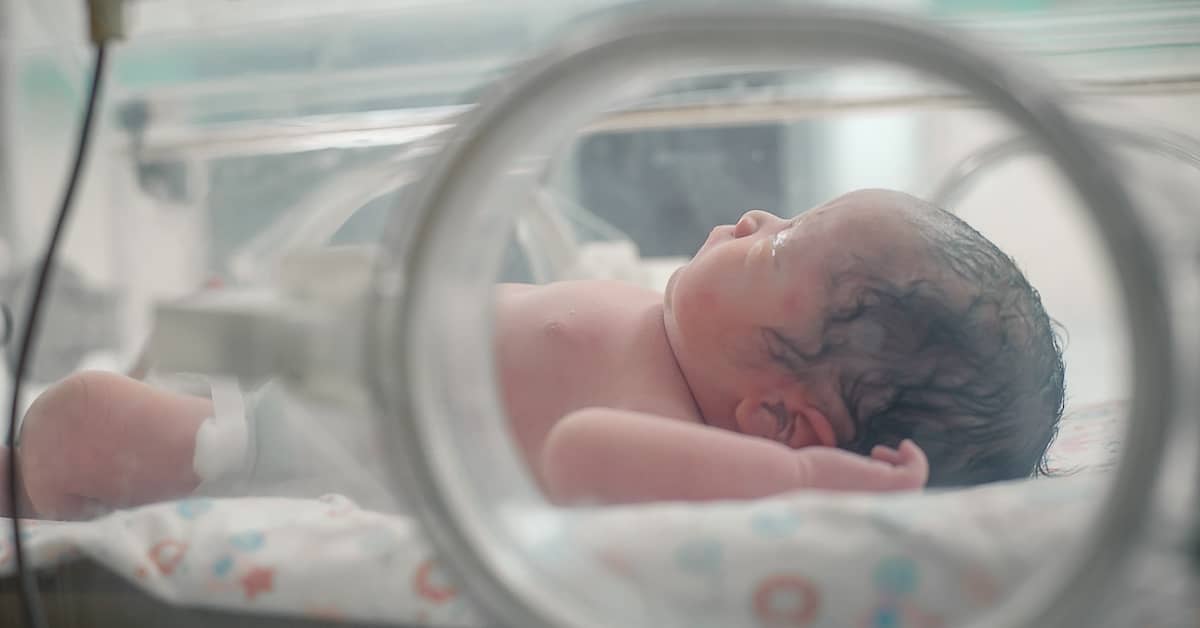 Baby with oxygen deprivation at birth in the neonatal intensive care unit | Burg Simpson