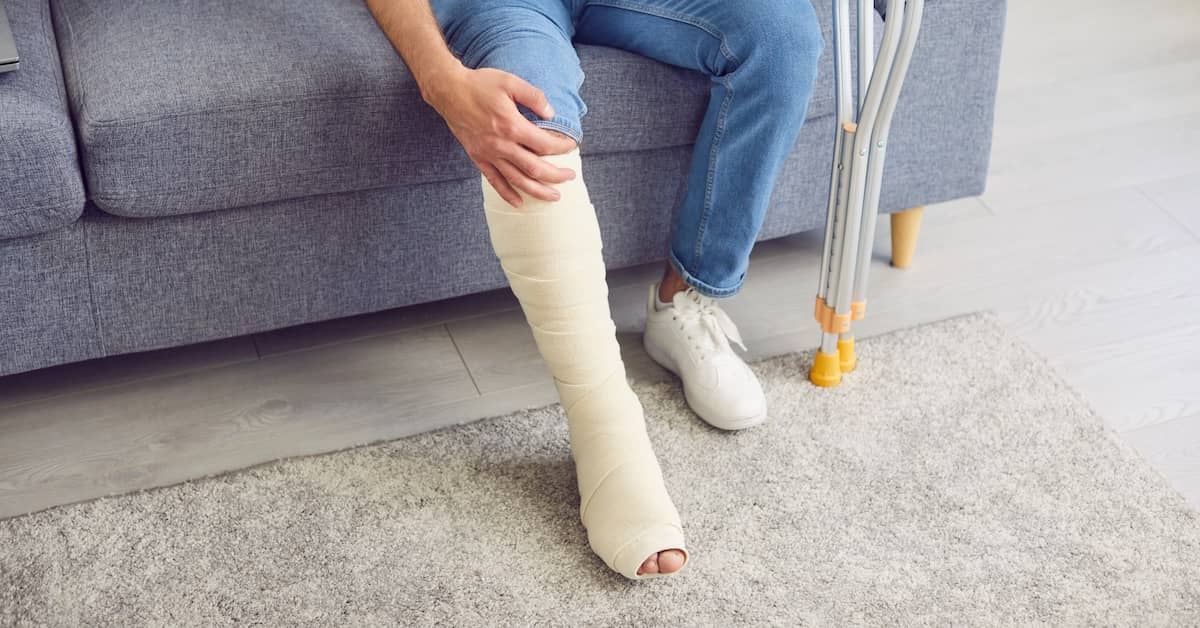 Man in leg cast grabbing his knee in pain | Burg Simpson